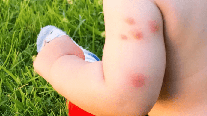 Buzzing Trouble in Australia: 3 Ways Mosquitoes Disrupt Your Baby's Sleep